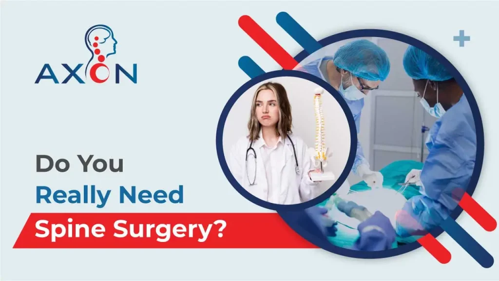 How to Know if You Really Need Spine Surgery?
